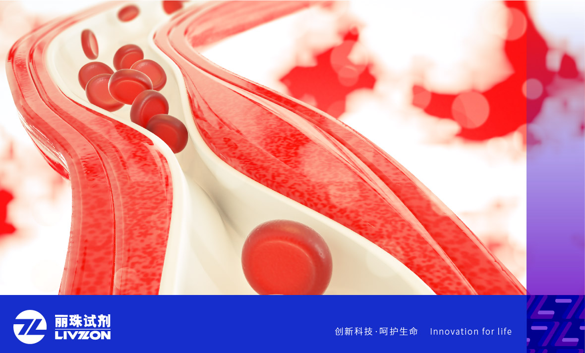 麗科普丨抗磷脂抗體陽性能診斷為「 抗磷脂綜合征 」嗎？